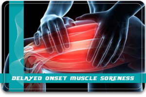 Delayed Onset Muscle Soreness 